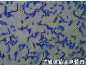 酪酸梭菌（图）