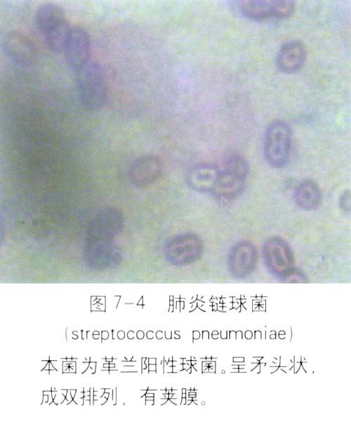 肺炎链球菌（图）