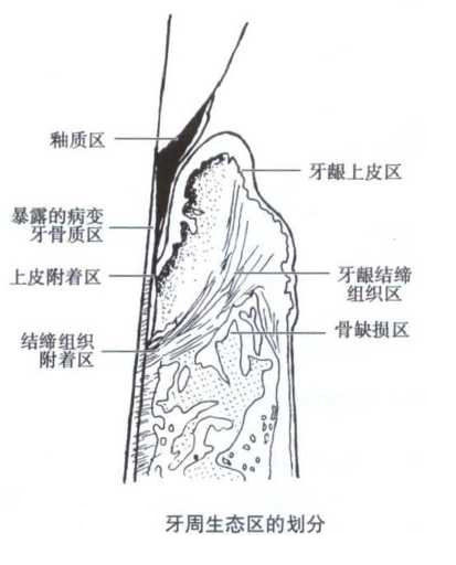 牙周生态区