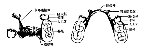 可摘局部义齿的组成及其作用——人工牙