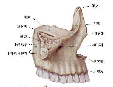 上颌骨解剖形态