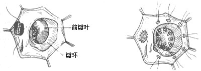 三尖瓣下移畸形应该如何治疗（图）？