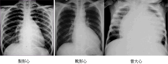 临床医师实践技能第三站-X线平片影像诊断（附图片）