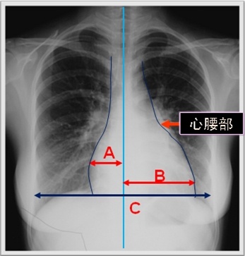 临床医师实践技能第三站-X线平片影像诊断（附图片）